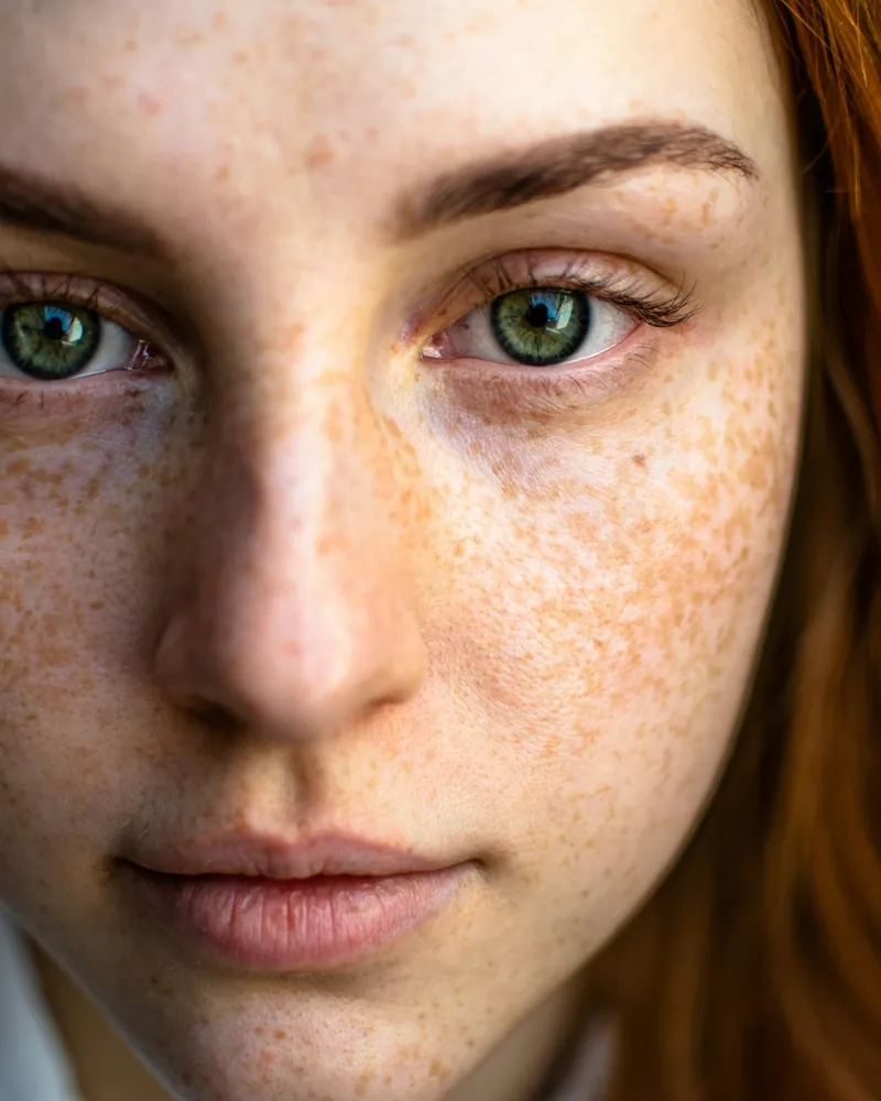 Close portrait showing natural freckled skin